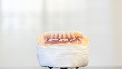 L’efficacia dell’implantologia con tempistiche ridotte grazie al metodo All-on-4.