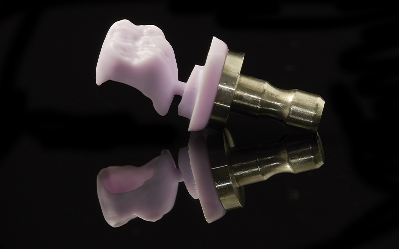 protesi cad cam protesi cad cam