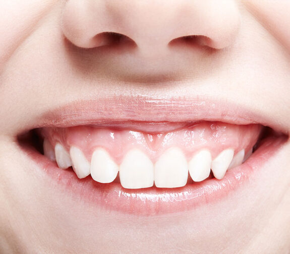 studio dentistico porro artusa trattamento gengivale