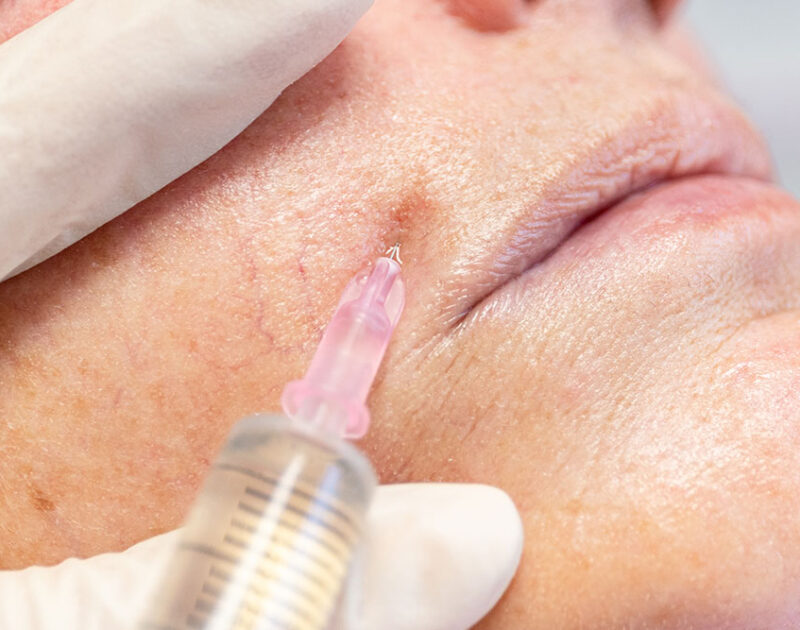 studio dentistico porro artusa trattamento medicina estetica botox studio dentistico porro artusa trattamento medicina estetica botox