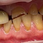 intervento riabilitazione bocca prima