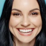 SBIANCAMENTO DENTALE