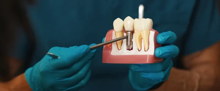 IMPLANTOLOGIA DIABETE