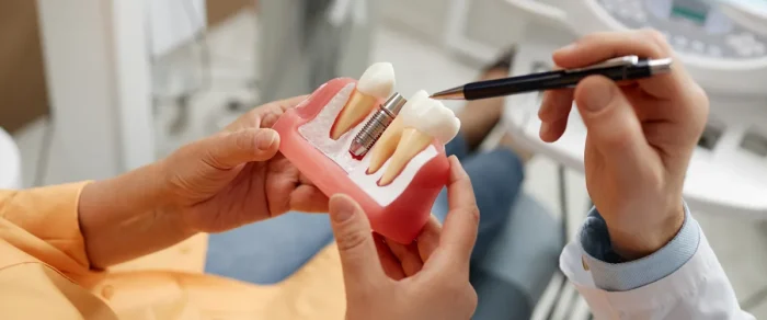 implantologia dentale segrate