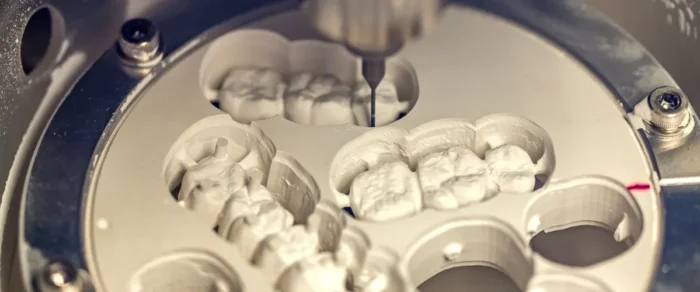 progettazione cad cam delle protesi: