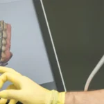 Protesi dentali CAD:CAM segrate