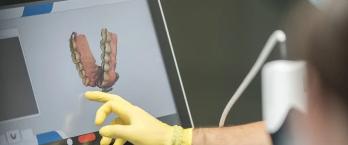 Protesi dentali CAD:CAM segrate